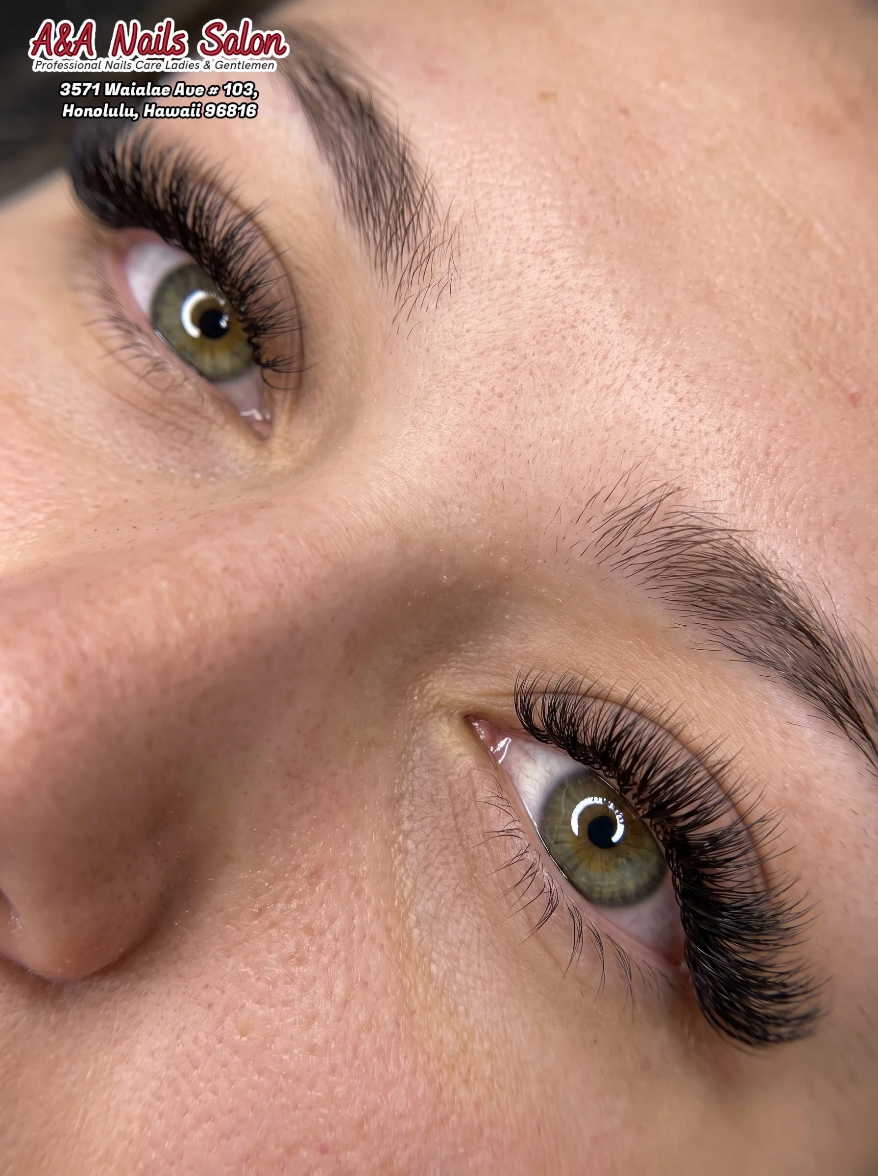 Eye